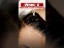 REVERSE HAIR LOSS AND STOP HAIR FALL #hairfall #hairloss #haircare