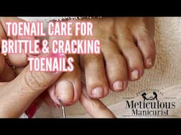 Toenail Repair & Fungus Removal | Restoring Brittle, Painful Toenails Step-by-Step