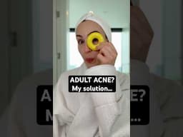 How I FINALLY cleared my ADULT ACNE 🥲 #acne #acnetreatment ZIIP Coupon Code ZIIPSOFIA #AD