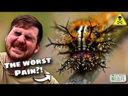 STUNG BY A Buck Moth CATERPILLAR! What HAPPENS!?