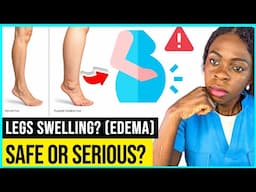 Swollen legs in pregnancy:Causes and tips by nurse mercy mary