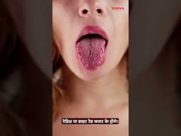 जबान का रंग कोनसा होना चाहिए ? Tongue Colour By Dr. Rupesh Amale