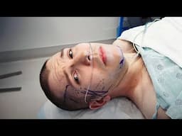 I'm Got A Face Lift & Neck Lift