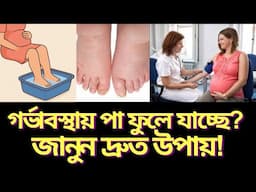 গর্ভাবস্থায় পা ফোলা? ঘরে বসেই সমাধান মাত্র ৭ দিনে!