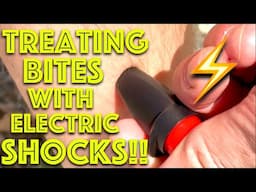 Do Electric Shocks REALLY stop insect bites itching?? Expedition medication -  Dr Gill