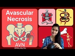 Avascular Necrosis (AVN) || Early Detection, Better Outcomes || ~xRay Pixy