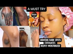 How to make Lightening Body scrub For Hyperpigmentation|DIY body scrub For Glowy Skin