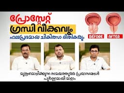 പ്രോസ്റ്റേറ്റ് ഗ്രന്ധി വീക്കവും ഫലപ്രദമായ ചികിത്സാ രീതികളും  | Prostate Disease | Urology Experts