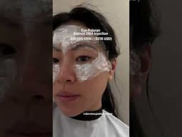 SKIN TREATMENTS I GOT IN KOREA #shorts