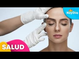 ¿Cuáles son los riesgos de la cirugía de párpados, una de las más realizadas? | Hoy Día | Telemundo