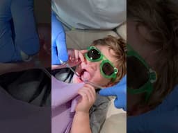 I had no idea Max had a lip tie! #pediatricdentist #Dentist #momlife #teeth