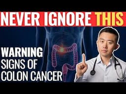 Warning Signs of Colon Cancer You Should Never Ignore