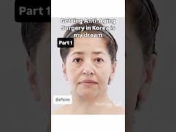 Regaining that youthful face again is a challenge! And Korea did it perfectly ✨ faceliftsurgery