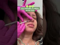 Fix Nostril Flaring with Tox!