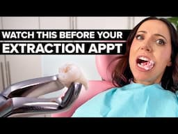 Getting a Tooth Pulled? WATCH THIS First!