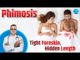 What is Phimosis? Is Phimosis Making Your P3N!S Look Small? Phimosis May Be the Cause!