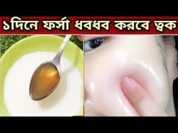 গরমে ফেসিয়াল এর চেয়ে ১০গুন গ্লো একদিনে ত্বকের কালো দাগ ময়লা তুলে ত্বক ফর্সা হবে/Besan Facepack