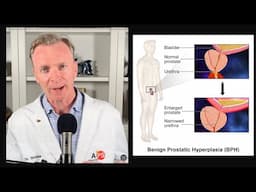 Natural PROSTATE Treatment for BPH, Health  & Longevity #163  | https://drstephenstokes.com
