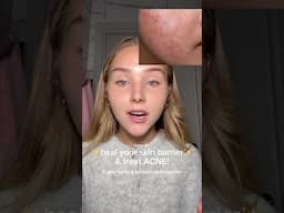 you can heal ACNE & skin BARRIER….. at the SAME time😱