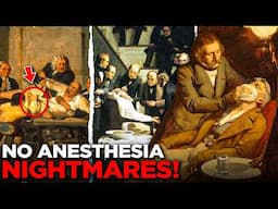 HORRORS of 19th Century Western Surgery (No Anesthesia Nightmares!)