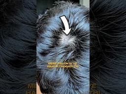 HOW TO STOP DANDRUFF AND GROW HAIR FAST #hairfall #haircare #dandruff