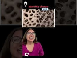 ⚕️It's time for Name this Disorder 🦴– Episode 44! Medical Surgical SHORT | @LevelUpRN