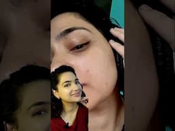 2 सस्ते Products = Spotless Skin! 🔥 #trending #trendingshorts #shorts #shortsfeed #ytshorts #yt