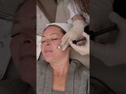 I Injected Salmon Sperm in my Face in South Korea! 🇰🇷