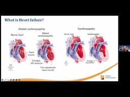 From Heart Failure to Heart Success
