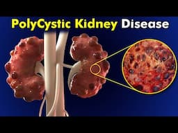 How Does Polycystic Kidney Disease Affect Your Body?