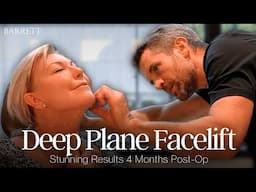 Facelift Journey Vlog: “I Still Look Like Myself, Just Younger!”