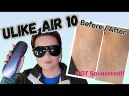 Stop Shaving! At Home IPL Hair Removal ULike AIR 10 Review NOT SPONSORED