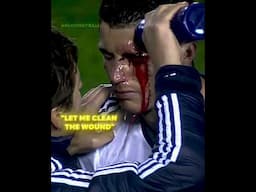 Ronaldo only need one eye 💀
