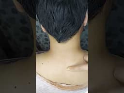 Clean Dark Neck #shorts #short #viral #viralsong #beautyhacks