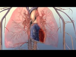 Right-Sided Heart Failure