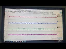EEG or ECoG recording in Rodents. LiNeuR