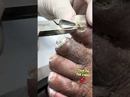 These Toenails Aged Like Cheese—4 Years of Growth! #satisfyingshorts #nailcutting #nails
