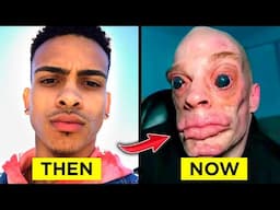 15 Shocking Race Transformation Surgeries That Ended in Regret!