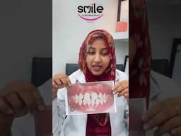 teeth aligners service in Pakistan #dermatologist  #dentalimplantcost  #dermatologist