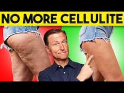 The FASTEST Way to Lose Cellulite