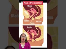 ⚕️It's time for Name this Disorder – Episode 43! 🔍: Medical Surgical SHORT | @LevelUpRN