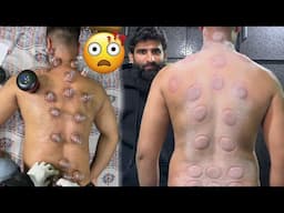 I Let Them Put 50 Cups on My Back… This Was Insane!