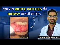 KYA SARE WHITE PATCHES MEY BIOPSY ZARURI HAI?