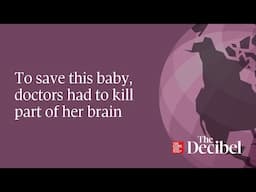 To save this baby, doctors had to kill part of her brain
