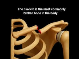 Clavicle Fracture: Symptoms, Types, Treatment, and Recovery