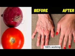 Use tomato onion wash for 5 days to remove wrinkles from hands completely / dry hands home remedies