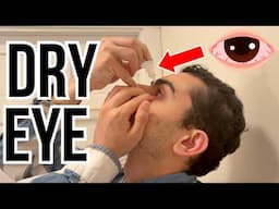 Doctor explains DRY EYE | Causes, treatment and a demonstration of how to correctly apply eye drops