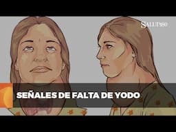 Así grita tu cuerpo que necesita yodo | Salud 180