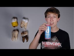 I Soaked My Wisdom Teeth in BANG