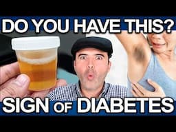 EARLY Diabetes Symptoms That Could SAVE Your Life (You Might Have It)